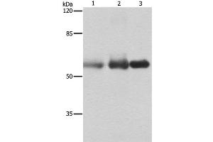 Western Blot analysis of Human cervical cancer, legs fibrous histiocytoma and fetal brain tissue using NECTIN1 Polyclonal Antibody at dilution of 1:400 (PVRL1 anticorps)