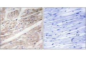 Immunohistochemistry analysis of paraffin-embedded human heart, using KIT (Phospho-Tyr936) Antibody.