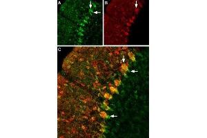 Expression of GABATR in rat cerebellum - Immunohistochemical staining of rat cerebellum using Anti-GABA Transporter 1 (GAT-1) (extracellular) Antibody (ABIN7043178, ABIN7044459 and ABIN7044460), (1:200).