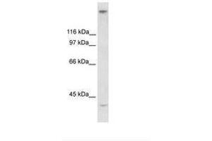 Image no. 2 for anti-Zinc Finger Protein 318 (Znf318) (AA 190-239) antibody (ABIN6735953) (ZNF318 anticorps  (AA 190-239))