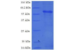 Proteasome (Prosome, Macropain) Subunit, beta Type, 7 (PSMB7) (AA 44-275), (partial) protein (GST tag)