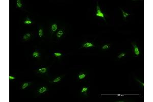 Immunofluorescence of monoclonal antibody to DLX3 on HeLa cell.