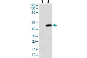 Western blot analysis of Lane 1: Negative control [HEK293 cell lysate]; Lane 2: Over-expression lysate [FTL (AA: 1-175)-hIgGFc transfected HEK293 cells] with FTL monoclonal antibody, clone 6E10E4  at 1:500-1:2000 dilution.