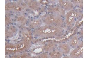 DAB staining on IHC-P; Samples: Rat Kidney Tissue (S100 Protein (S100) (AA 1-94) anticorps)
