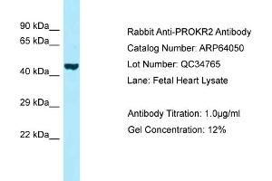 Western Blotting (WB) image for anti-Prokineticin Receptor 2 (PROKR2) (C-Term) antibody (ABIN2789711)