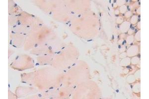 Detection of LAMa4 in Mouse Skeletal muscle Tissue using Polyclonal Antibody to Laminin Alpha 4 (LAMa4)
