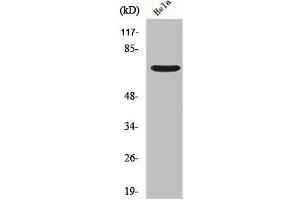 Western Blot analysis of Hela cells using Frizzled-1 Polyclonal Antibody (FZD1 anticorps  (N-Term))