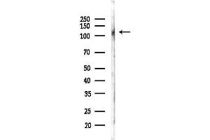 anti-Ankyrin Repeat Domain 27 (VPS9 Domain) (ANKRD27) antibody