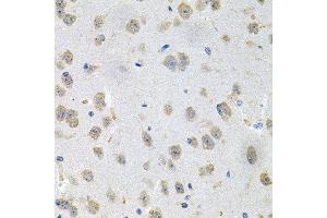 Immunohistochemistry of paraffin-embedded mouse brain using GNE antibody at dilution of 1:100 (x40 lens). (GNE anticorps)