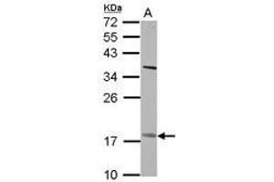 Image no. 2 for anti-Patatin-Like phospholipase Domain Containing 4 (PNPLA4) (AA 1-249) antibody (ABIN1500317) (PNPLA4 anticorps  (AA 1-249))