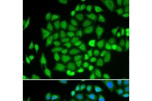 Immunofluorescence analysis of HeLa cells using AKR7A2 Polyclonal Antibody (AKR7A2 anticorps)