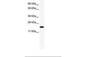 Image no. 1 for anti-Cbp/p300-Interacting Transactivator, with Glu/Asp-Rich Carboxy-terminal Domain, 4 (CITED4) (AA 31-80) antibody (ABIN202045) (CITED4 anticorps  (AA 31-80))