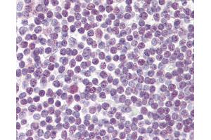 Anti-DDX18 antibody IHC of human tonsil. (DDX18 anticorps  (AA 20-70))