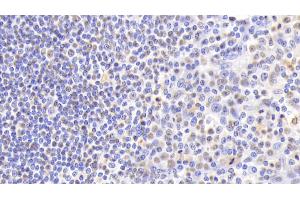 Detection of NPM1 in Human Tonsil Tissue using Polyclonal Antibody to Nucleophosmin 1 (NPM1)