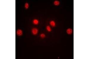 Immunofluorescent analysis of c-Jun staining in HeLa cells. (C-JUN anticorps)