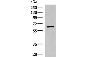 Western blot analysis of Human placenta tissue lysate using PDIA5 Polyclonal Antibody at dilution of 1:1000 (PDIA5 anticorps)