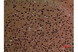 Immunohistochemistry (IHC) analysis of paraffin-embedded Mouse Brain, antibody was diluted at 1:100. (CDH6 anticorps  (Internal Region))