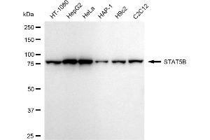 Western blotting analysis using STAT5B antibody (ABIN7800348). (Recombinant STAT5B anticorps)