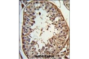Formalin-fixed and paraffin-embedded human testis tissue reacted with ANGEL1 Antibody (C-term), which was peroxidase-conjugated to the secondary antibody, followed by DAB staining. (ANGEL1 anticorps  (C-Term))