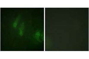 Immunofluorescence analysis of HeLa cells, using FANCA (Phospho-Ser1149) Antibody. (FANCA anticorps  (pSer1149))