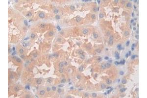 DAB staining on IHC-P; Samples: Human Kidney Tissue