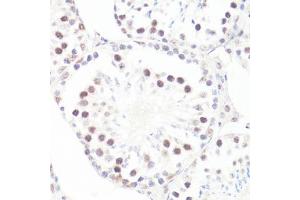 Immunohistochemistry of paraffin-embedded mouse testis using P-MYC-S62 antibody (ABIN3019544, ABIN3019545, ABIN3019546 and ABIN6225456) at dilution of 1:100 (40x lens). (c-MYC anticorps  (pSer62))