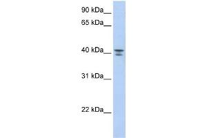 WB Suggested Anti-GNA12 Antibody Titration: 0. (GNA12 anticorps  (Middle Region))