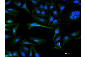 Immunofluorescence of purified MaxPab antibody to OR8B8 on HeLa cell.