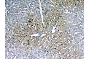 IHC analysis of IGFBP1 using anti-IGFBP1 antibody .