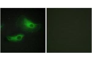 Immunofluorescence analysis of HeLa cells, using ADD2 Antibody. (ADD2 anticorps  (AA 471-520))