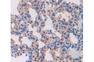 Used in DAB staining on fromalin fixed paraffin- embedded lung tissue (ABCA8 anticorps  (AA 1303-1514))