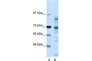 WB Suggested Anti-NCOR2 Antibody Titration:  0. (NCOR2 anticorps  (N-Term))