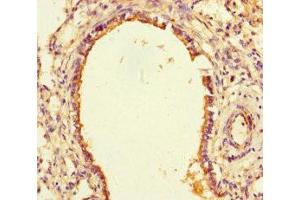 Immunohistochemistry of paraffin-embedded human lung tissue using ABIN7169807 at dilution of 1:100