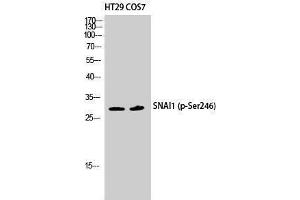 Western Blotting (WB) image for anti-SNAIL (SNAI1) (pSer246) antibody (ABIN3182456) (SNAIL anticorps  (pSer246))
