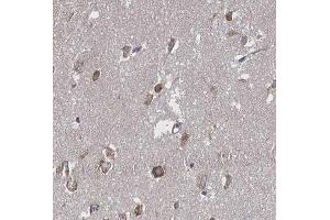 ABIN6266655 at 1/100 staining human brain tissue sections by IHC-P.