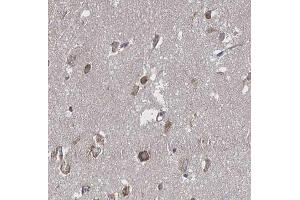 ABIN6266655 at 1/100 staining human brain tissue sections by IHC-P. (PIAS3 anticorps  (N-Term))