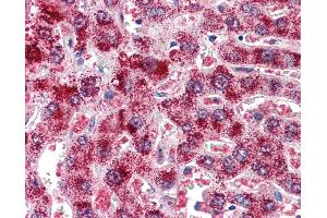 Anti-Catalase antibody IHC of human liver. (Catalase anticorps  (AA 498-511))