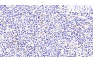 Detection of IL6 in Human Spleen Tissue using Polyclonal Antibody to Interleukin 6 (IL6)