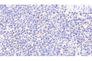 Detection of IL6 in Human Spleen Tissue using Polyclonal Antibody to Interleukin 6 (IL6) (IL-6 anticorps  (AA 29-212))
