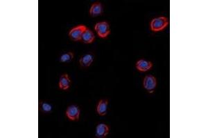 Immunofluorescent analysis of GLUR1 staining in A549 cells. (Glutamate Receptor 1 anticorps  (C-Term))