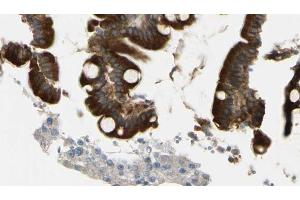 ABIN6269264 at 1/100 staining Mouse intestine tissue by IHC-P. (Crk anticorps)