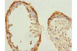 Immunohistochemistry of paraffin-embedded human testis tissue using ABIN7147293 at dilution of 1:100 (CDC7 anticorps  (AA 275-574))