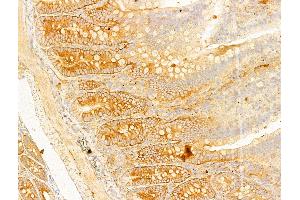 ABIN6255513 and ABIN6267630 at 1/100 staining Rat colon tissue by IHC-P. (Acetyl-CoA Carboxylase alpha anticorps  (pSer79, pSer80))
