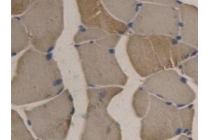 DAB staining on IHC-P; Samples: Rat Skeletal muscle Tissue (APOB anticorps  (AA 2747-2913))