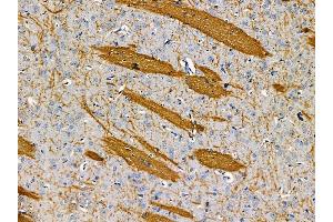 ABIN7095543 and ABIN7099600 at 1/100 staining rat brain tissue by IHC-P. (RARS anticorps)