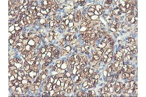 Image no. 1 for anti-phosphofructokinase, Platelet (PFKP) antibody (ABIN1500161)