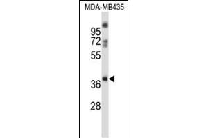 GPR15 Antibody (C-term) (ABIN657988 and ABIN2846935) western blot analysis in MDA-M cell line lysates (35 μg/lane).