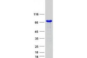 Validation with Western Blot