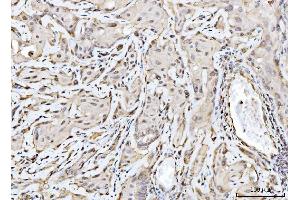 IHC analysis of RAE1 using anti-RAE1 antibody (ABIN7602428). (RAE1 anticorps  (AA 76-368))