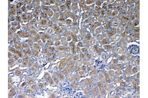 IHC analysis of CD151 using anti- CD151 antibody . (CD151 anticorps  (AA 113-175))